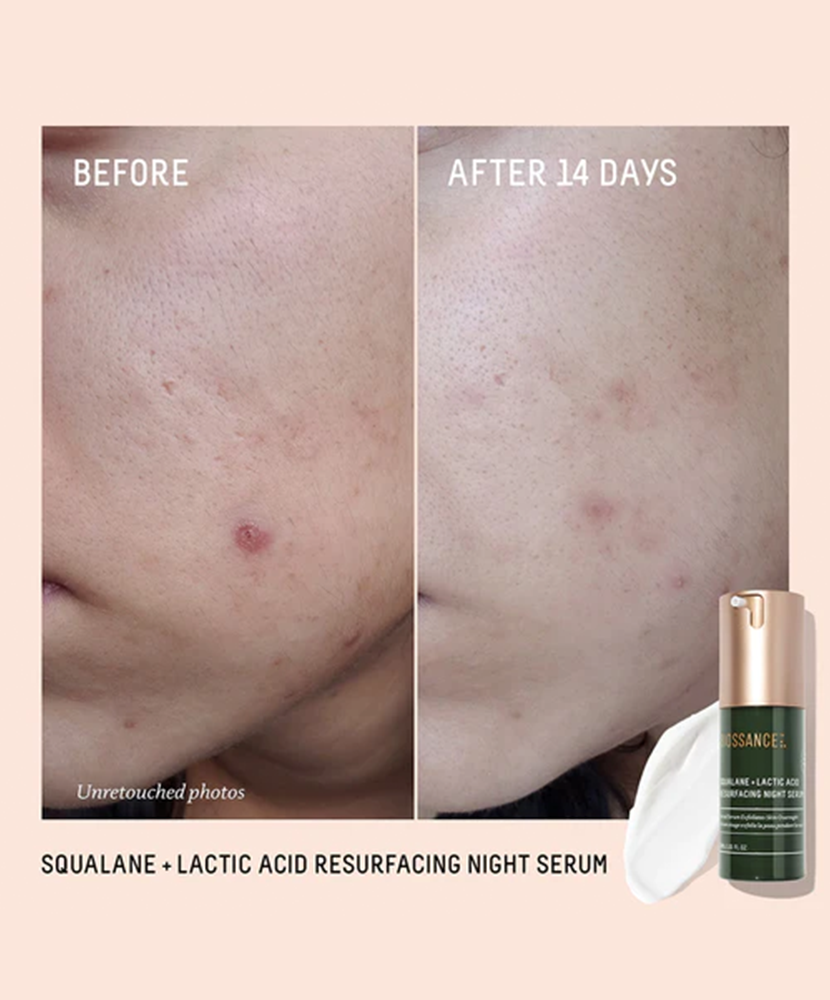 Biossance Lactic Acid Squalane Serum before after