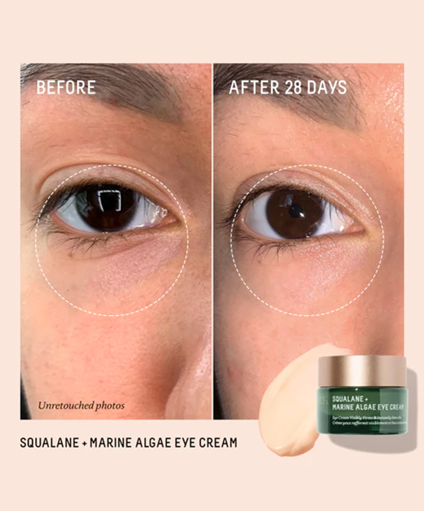 Biossance Eye Cream before after